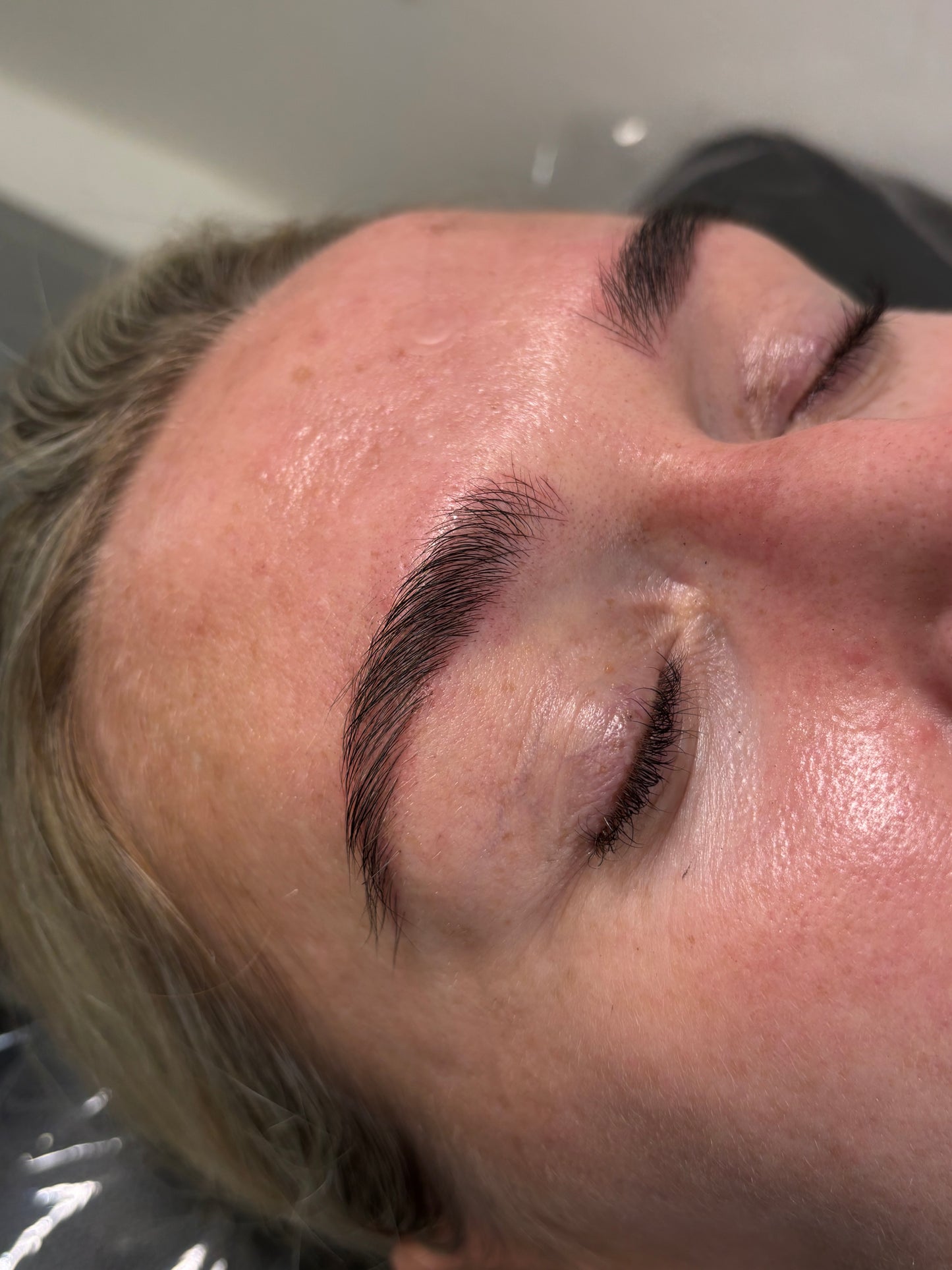 NANOBLADING with free retouch