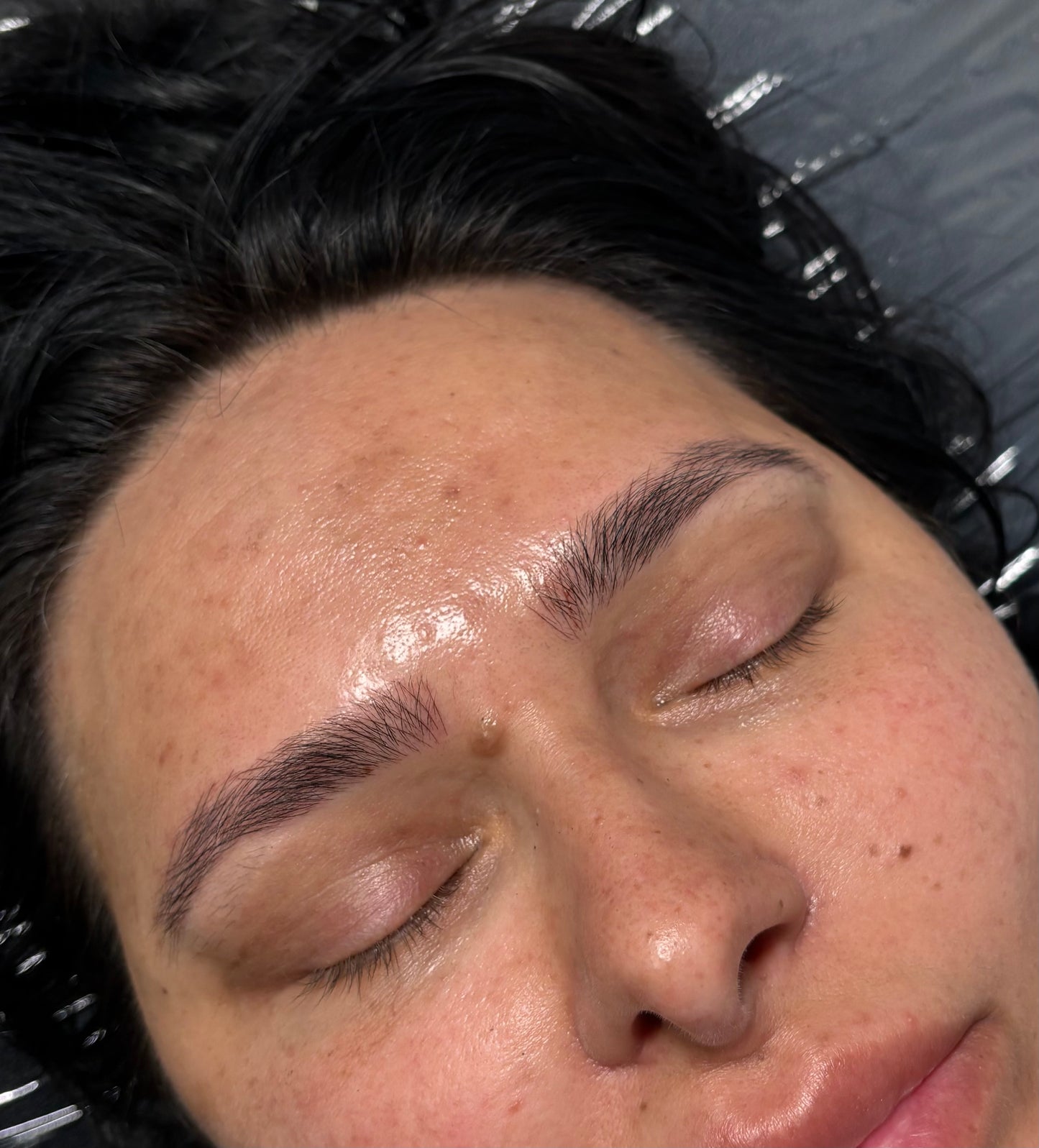 NANOBLADING with free retouch