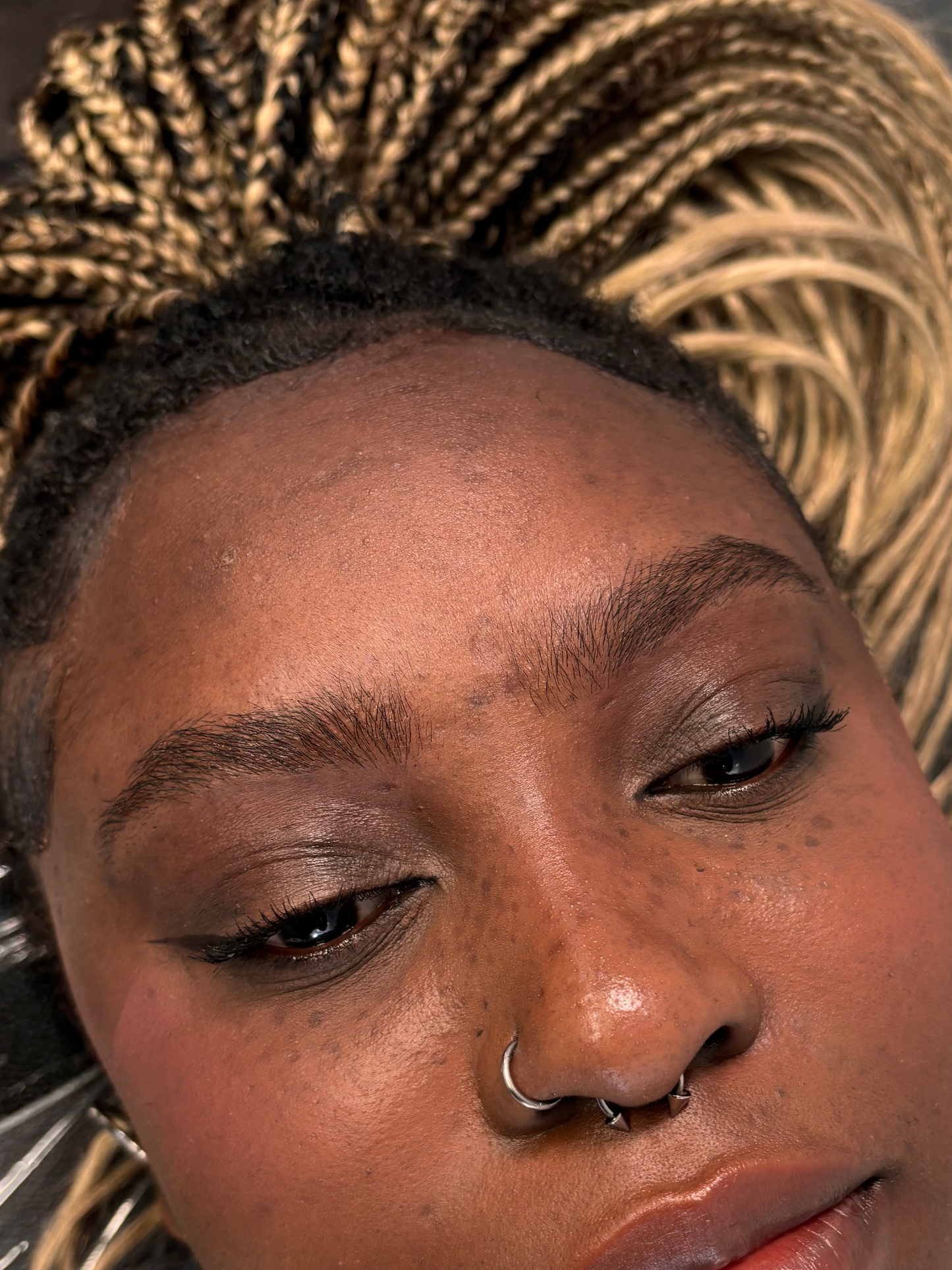 NANOBLADING with free retouch